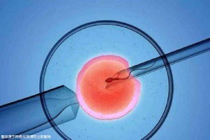 关于有偿同志供卵代孕怎么预约